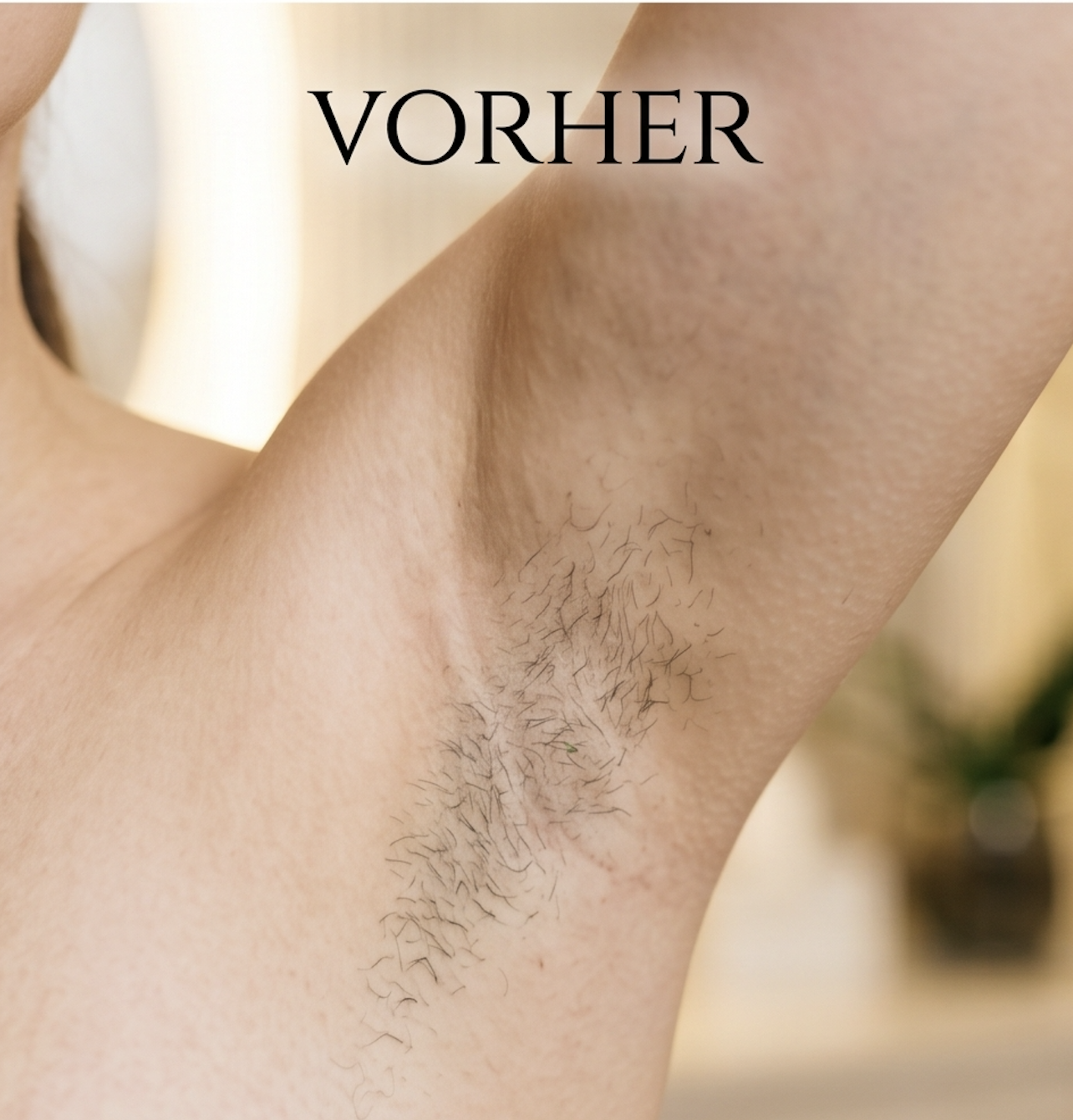 Achseln Vorher