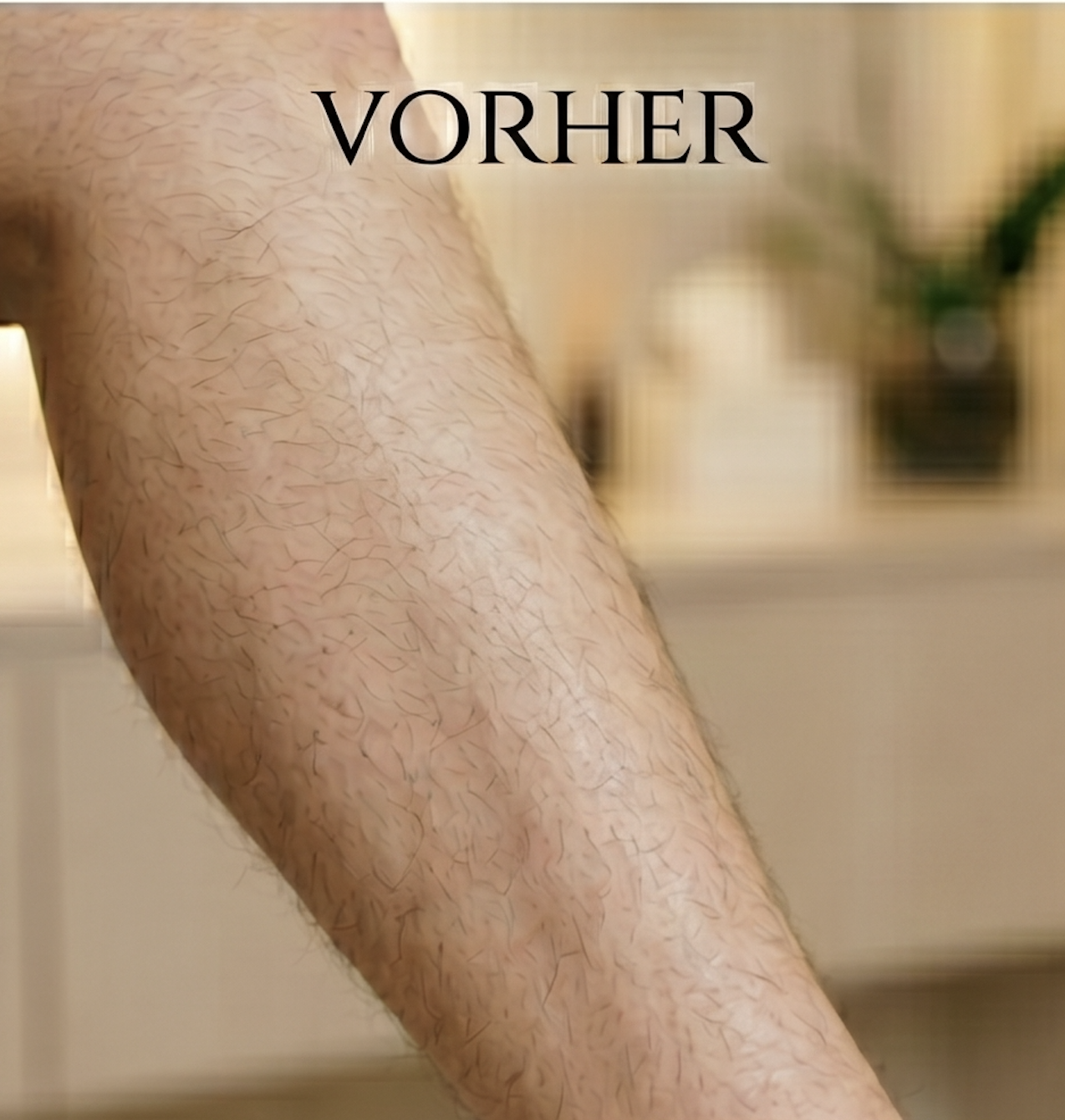 Beine Vorher