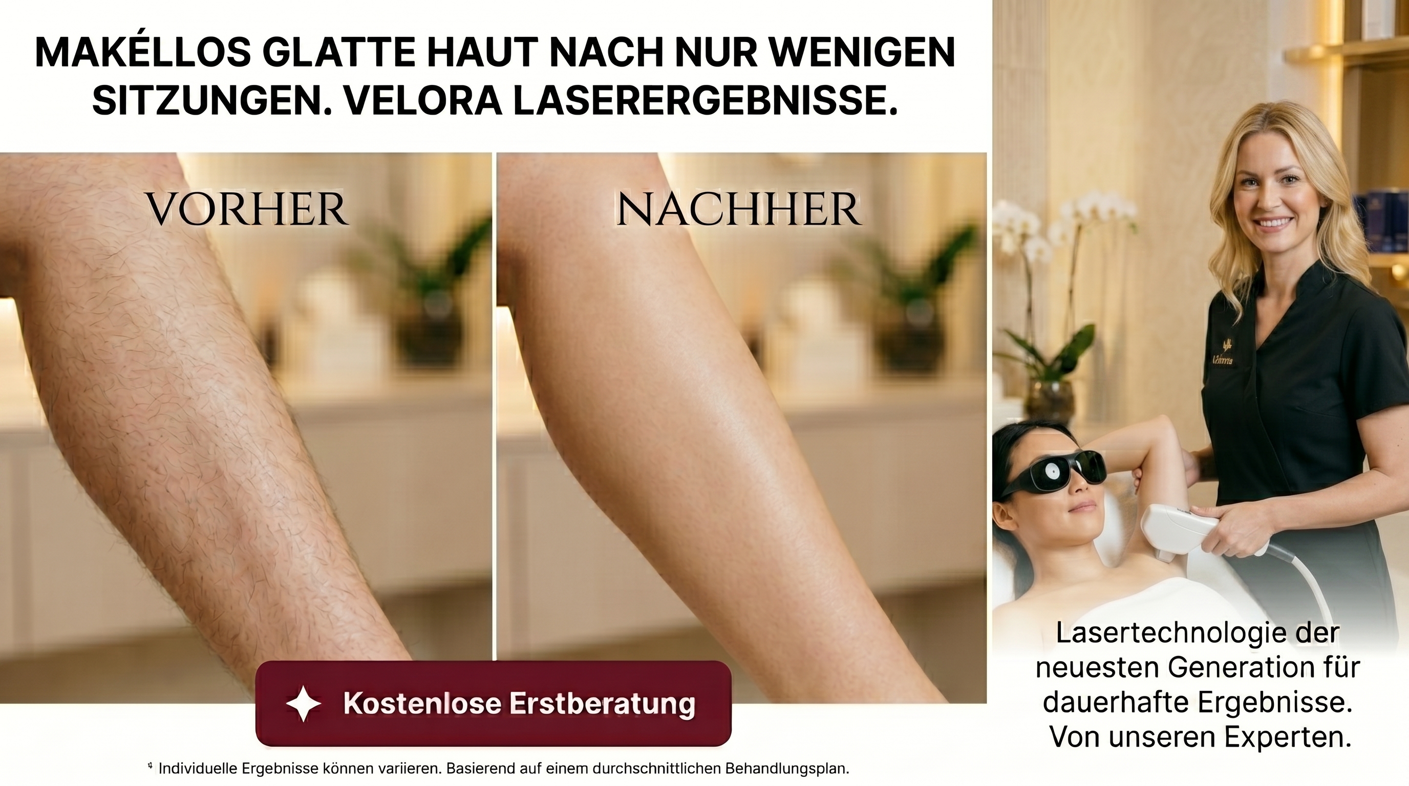 Velora Laserergebnisse – Beine vorher nachher